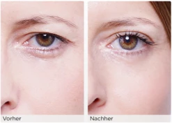 Augenlid-Liftingstripes Gr. M -Pflegeprodukte MAM 3810469 SHOP IMAGE 1.4